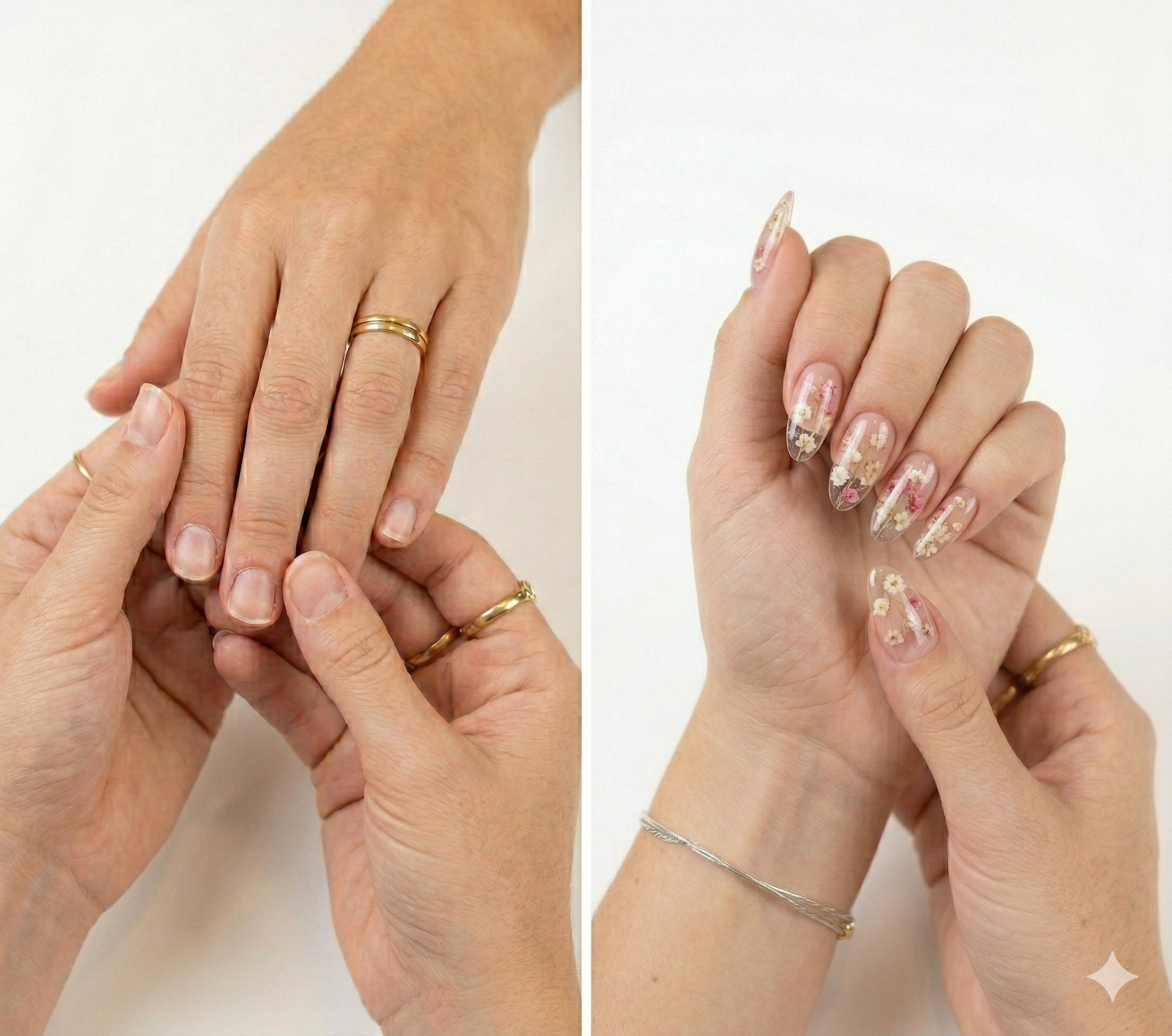 Antes e depois - encapsulado com flores